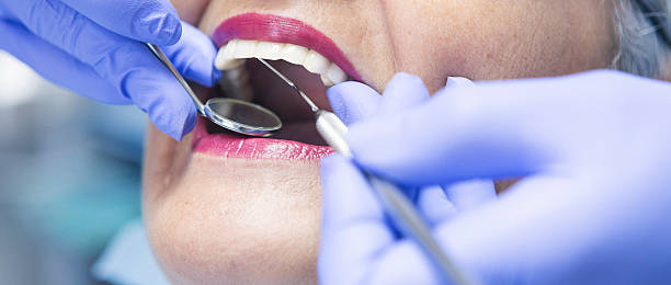 Best Broken or Chipped Tooth Repair in Hastings, PA